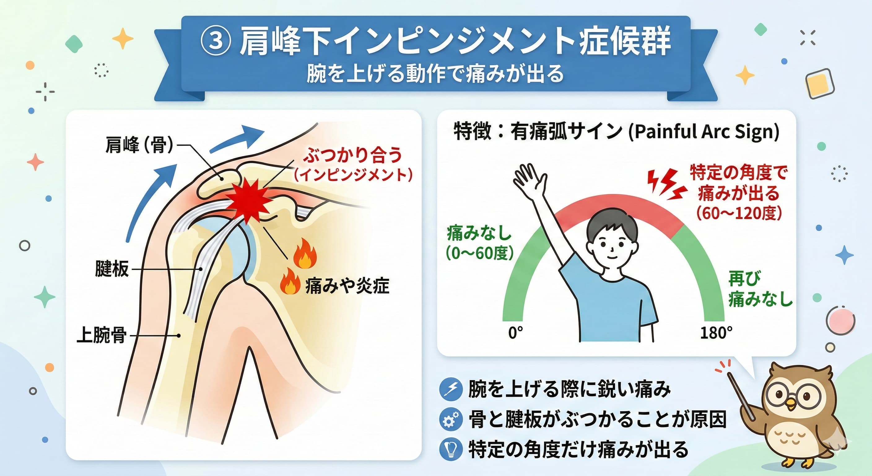 肩峰下インピンジメント症候群のイメージ