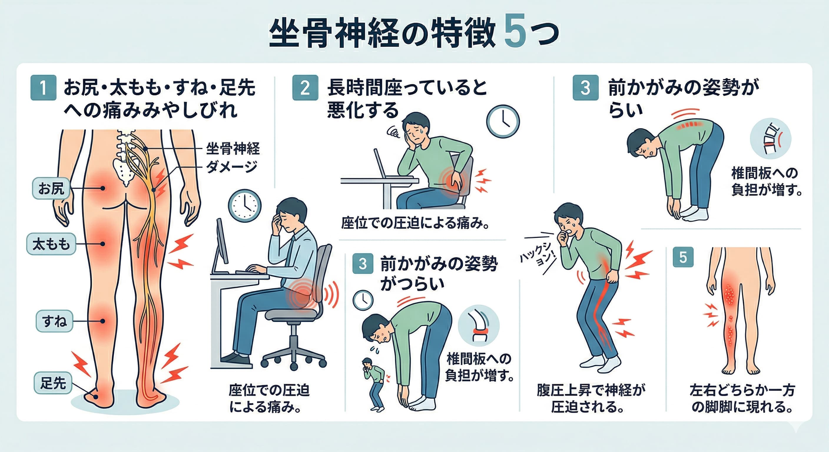 坐骨神経痛 整骨院 名古屋