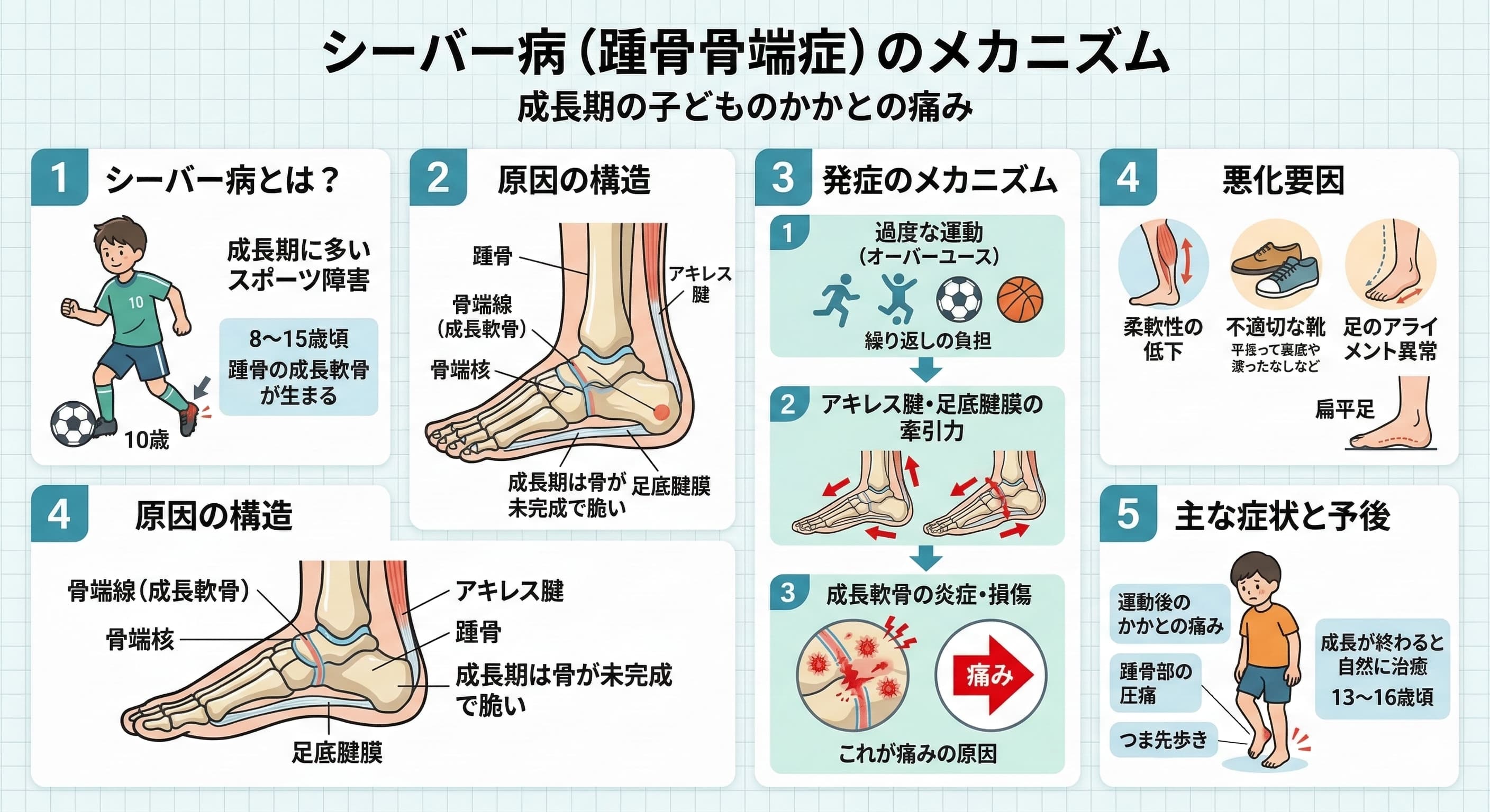 シーバー病（踵骨骨端症）のイメージ