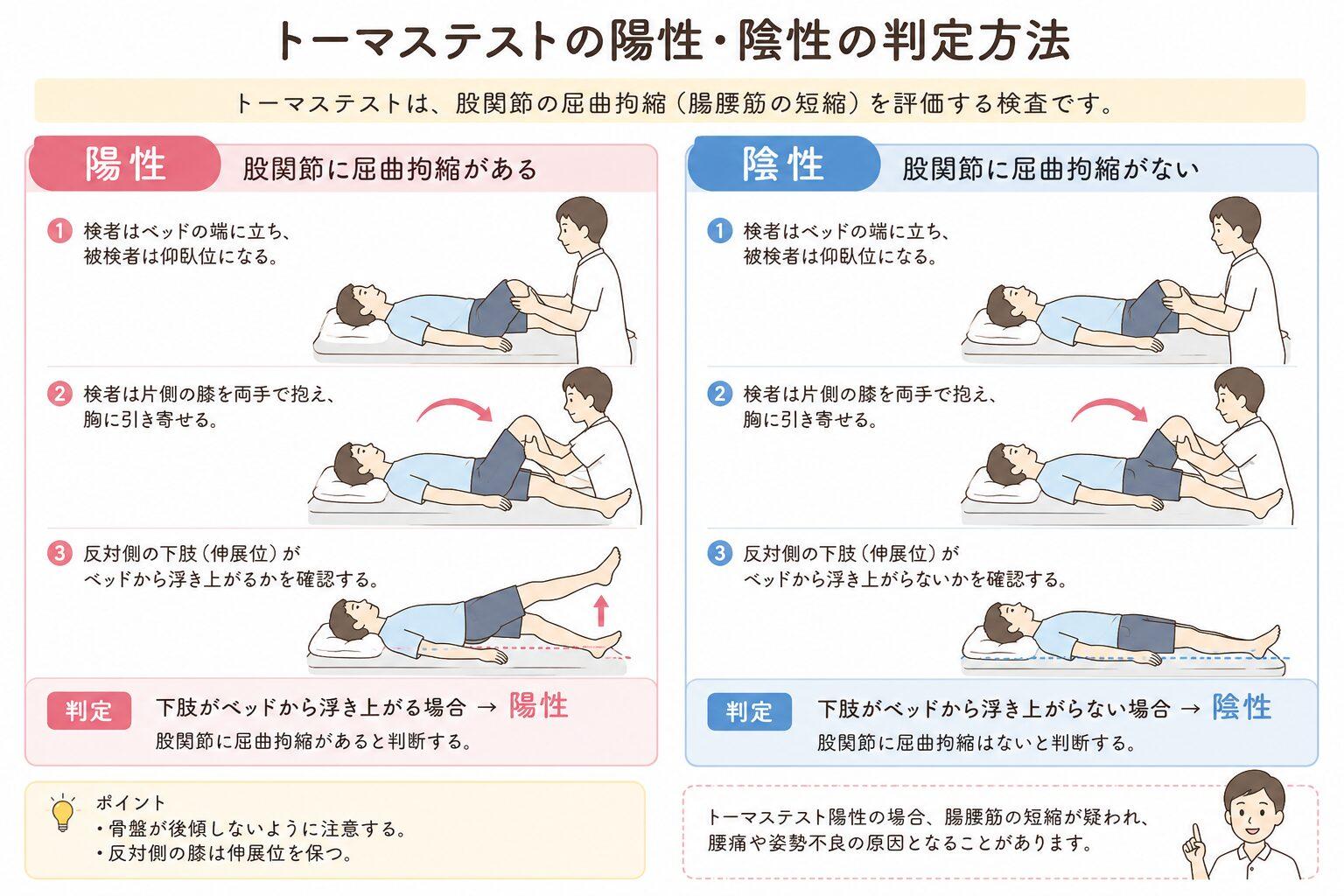 トーマステストの陽性・陰性の判定方法