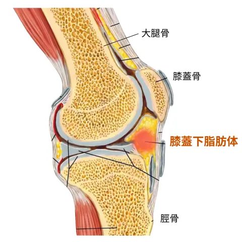 膝蓋下脂肪体炎の膝の痛みを名古屋市昭和区の整骨院・接骨院で確認する様子